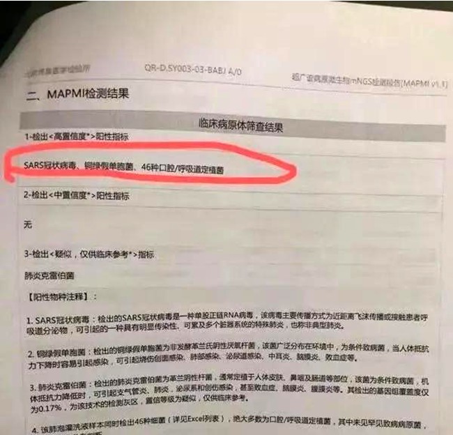 李文亮2019年12月30日转发艾芬提供的病毒检测报告